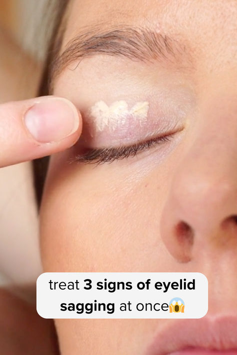 Here's a Great Solution Recommended by Beauty Experts to Smoothen Out & Lift Droopy Eyelids Crepey Eyelids Remedy, How To Get Rid Of Droopy Eyelids, Crepey Eyelids, Saggy Eyelids, Dark Spots Under Eyes, Sagging Eyelids, Droopy Eyelids, Droopy Eyes, Eyelid Lift