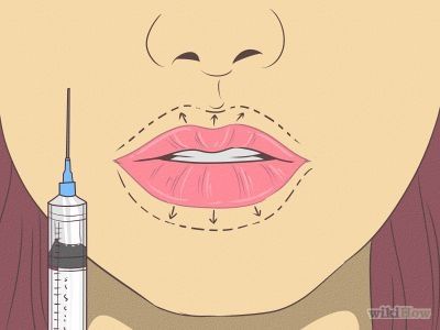 How to Make Lips Look Bigger -- via wikiHow.com Make Lips Look Bigger, Lips Look Bigger, Plumper Lips, How To Get Bigger, Labret Piercing, Lip Plumper, Genetic, A Sign, 5 Ways