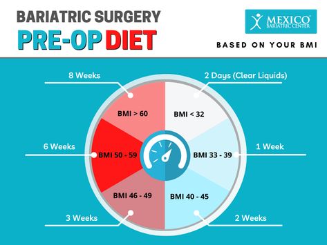 Gastric Bypass Pre Surgery Diet, Bariatric Recipes Pre Surgery, Pre Op Vsg Diet, Mexico Bariatric Center, Gastric Bypass Recipes Liquid Diet Pre Op, Bariatric Sleeve Pre Op Diet, Pre Op Diet For Sleeve, Pre Gastric Bypass Diet, Full Liquid Diet Bariatric Pre Op