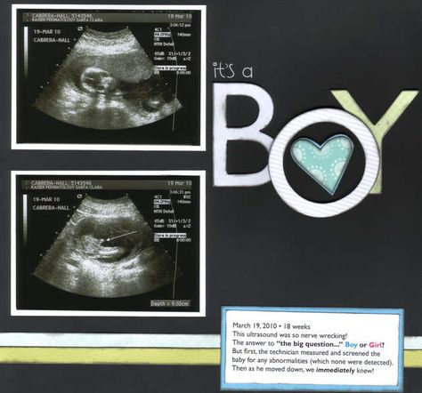 *It's a BOY! Ultrasound Scrapbook, Baby Boy Scrapbook Layouts, Pregnancy Scrapbook, Mighty Mike, Scrapbook Bebe, Scrapbook Gallery, Boy Scrapbook Layouts, Baby Ultrasound