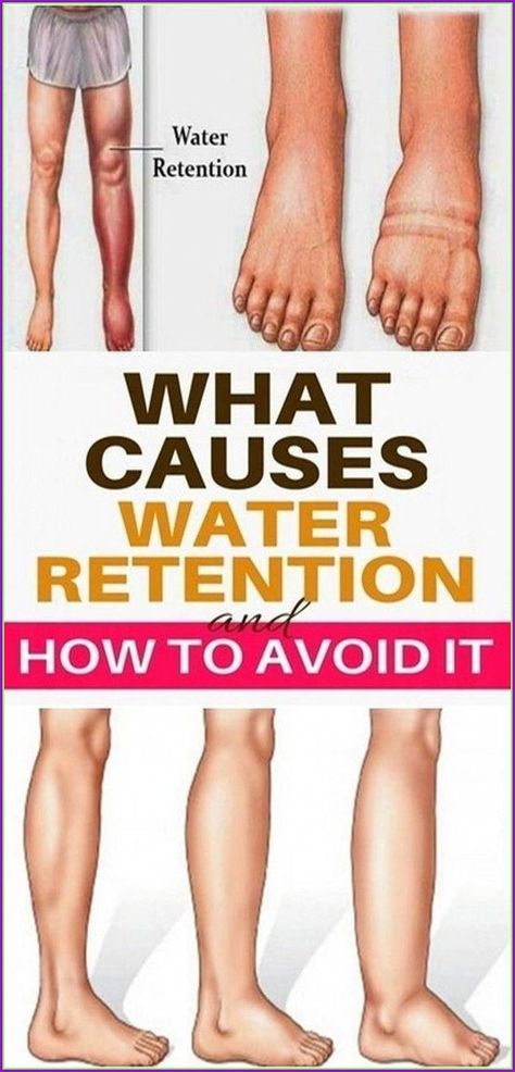 You wont have fat anymore-click here to know more #weightlos Water Retention Remedies, Physical Inactivity, Endocannabinoid System, Sedentary Lifestyle, Water Retention, Circulatory System, Good Health Tips, Health Info, Inbound Marketing