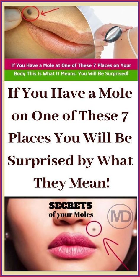 IF YOU HAVE A MOLE AT ONE OF THESE 7 PLACES ON YOUR BODY THIS IS WHAT IT MEANS Mole Meaning, Cleanse Recipes, Back Pain Exercises, Men's Health Fitness, Health And Fitness Tips, Health Facts, Body Skin Care, Mole, Healthy Drinks