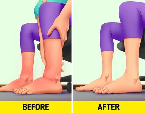 10 Tips for Swollen Legs Your Body Will Thank You For Improve Leg Circulation, Lemon Health, Lymph Drainage Massage, Leg Circulation, Swollen Knee, Swollen Ankles, Lymph Drainage, Swollen Legs, Leg Cramps