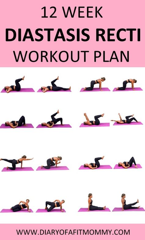 Yoga Diastasis Recti, Diastasis Recti Healing, Ab Workouts Diastasis Recti, Exercises For Post Partum Belly, Post Partum Core Workout At Home, Core Workouts For Diastis Recti, Diastis Recti Exercises Workout Plan, Mommy Exercises At Home, Diastis Recti Repair