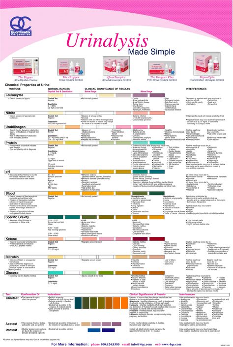 Urinalysis Dipstick Interpretation #Diagnosis #Urinalysis ... Urine Analysis Cheat Sheet, Urinalysis Cheat Sheet, Urinalysis Interpretation, Memes Nursing, Phlebotomy Study, Medical Laboratory Science Student, Nursing Labs, Nursing Pictures, Medical Lab Technician