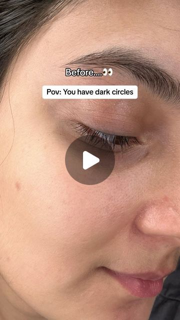 Homemade Dark Circle Eye Cream, Homemade Eye Mask For Dark Circles, How To Get Rid Of Dark Circles Under Eye, Coffee Eye Mask, Dark Circles Remedies, Mask For Dark Circles, Homemade Eye Cream, Dark Circle Remedies, Coffee Mask