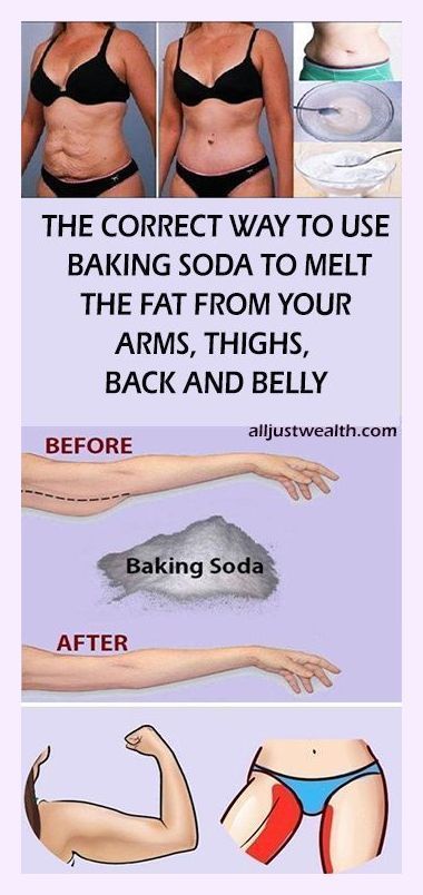 Hemma Diy, Natural Healing Remedies, Baking Soda Shampoo, Natural Therapy, Mom Hacks, روتين العناية بالبشرة, Herbal Remedies, Natural Healing, Weight Gain