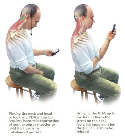 Forward Head Posture Exercises, Text Neck, Alexander Technique, Forward Head Posture, Chiropractic Clinic, Chiropractic Wellness, Posture Exercises, Shoulder Muscles, Neck And Back Pain