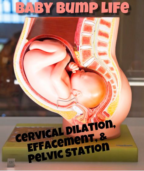 Learn what to expect from a cervical exam... explained by Nurse Whit 👩🏻‍⚕️❤️ (cervical dilation, effacement, and pelvic station) #childbirth #childbirtheducation #babytips #babytips #cervical #labor #labornurse #nurselife Dilation Station, Cervical Dilation, Labor Delivery Nursing, Baby Delivery, Labor Nurse, Turmeric Health, Delivery Nurse, Childbirth Education, Labor Delivery