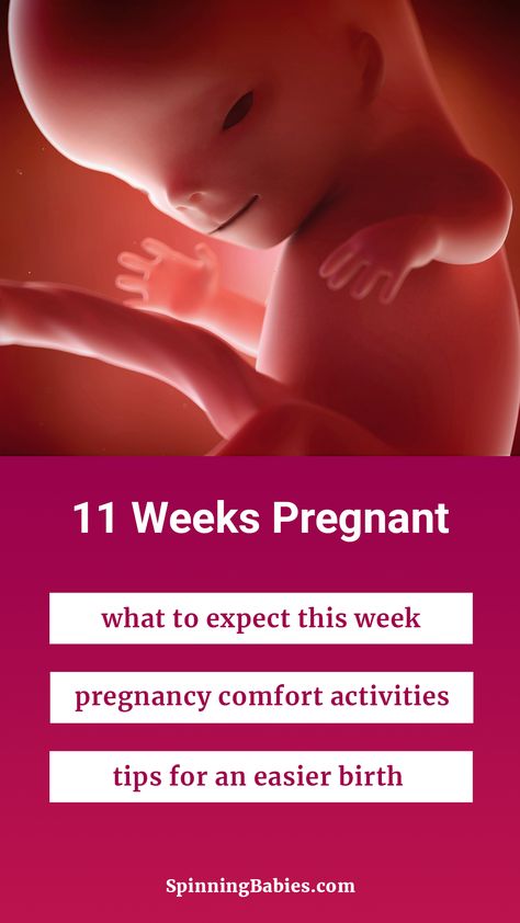 What to expect during week 11 of pregnancy plus Spinning Babies® tips and techniques for pregnancy comfort and preparing your body for an easier birth. Week 8 Pregnancy, 8 Weeks Pregnant, 9 Weeks Pregnant, 11 Weeks Pregnant, 10 Weeks Pregnant, Pregnancy Due Date, Spinning Babies, Pregnancy Week, Ways To Sleep