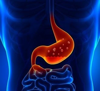 Stomach acid is a necessary and vital part of digestion. Yet, stomach acid has become enemy number one in the United States. Ibs Diet Plan, Sistem Pencernaan, Ibs Diet, Body Wisdom, Food For Digestion, Gaps Diet, Ayurvedic Remedies, Acidic Foods, High Fat Foods