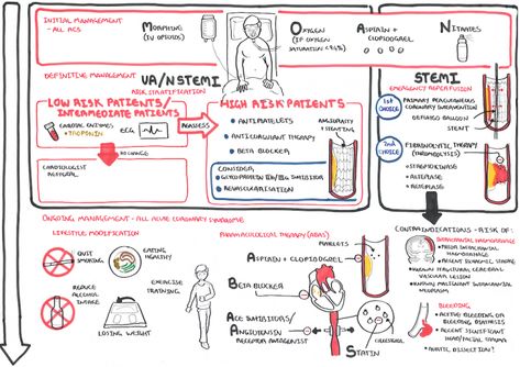 Overview Overview Angina Pectoris refers to the pain caused by myocardial ischaemia. Myocardial Ischaemia is usually caused by stenosis within the vessel decreasing blood flow to the muscle, but it can be caused by tachycardia, anaemia, aortic stenosis Angina Nursing, Medicine Facts, Armando Hasudungan, Disease Infographic, Nursing School Supplies, Nurse Notes, Np School, Acute Coronary Syndrome, Cushings Syndrome