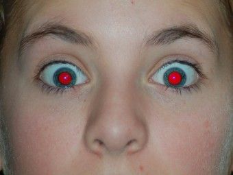 What Causes Red Eyes In Photographs What Causes Red Eyes, Red Eye Photo, Vampire Eyes, Red Eye Flight, Photos Of Eyes, Eyes Problems, Lightroom Tutorial, Eye Photography, Red Eye