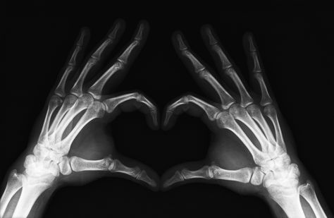 X-Ray Heart by ~mmattes on deviantART - very cool. Radiology Humor, Rad Tech Week, Radiologic Technology, Xray Art, Photographie Indie, Radiology Tech, Fb Cover Photos, Xray Tech, Rad Tech