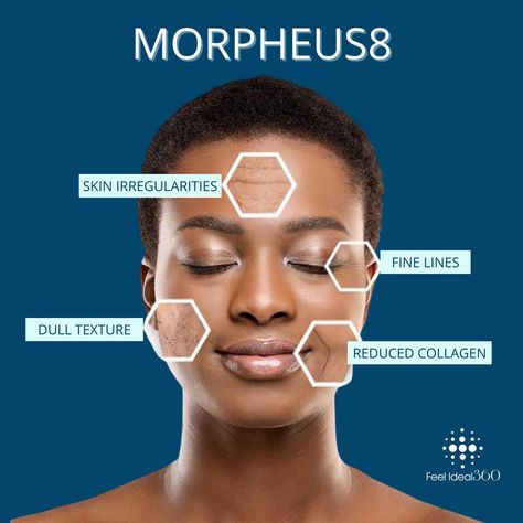 Skin Theory, Morpheus 8, Rf Microneedling, Skin Poster, Laser Facial, Skin Facts, Skin Aesthetics, Healing Waters, Aesthetic Medicine