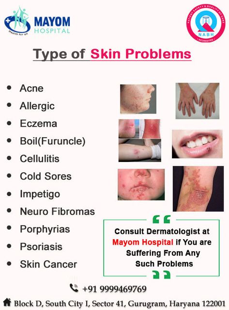 Skin Diseases And Disorders, Skin Disorders And Diseases, Skin Diseases Pictures, Study Esthetics, Doctor Knowledge, Skin Conditions Pictures, Skin Diagram, Motorola Wallpapers, Eye Specialist