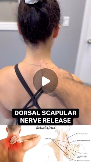 FisioTerapia🩻 on Instagram: "What Does a Pinched Dorsal Scapular Nerve Feel Like?🦴  🤕Experiencing sharp, stabbing pain or a deep ache between your shoulder blades? Does the discomfort radiate down your back or make it tough to move your neck and shoulders freely? You might be dealing with an irritated or pinched dorsal scapular nerve.  📚 Anatomy & Function: The dorsal scapular nerve originates from the C5 nerve root in your neck, running down to innervate the rhomboid muscles and the levator scapulae. These muscles are crucial for stabilizing and moving your shoulder blades, playing a key role in shoulder and upper back movements.  🩺 Symptoms: • Sharp, localized pain between the shoulder blades • Radiating discomfort to the upper back or neck Muscle weakness or spasms in the affected Knots In Neck Muscle, Pulled Neck Muscle, Pinched Nerve In Shoulder, Muscle Spasms Relief, Shoulder Pain Remedies, Pinched Nerve In Neck, Neck Muscle Pain, Shoulder Blade Muscles, Neck Muscle Anatomy