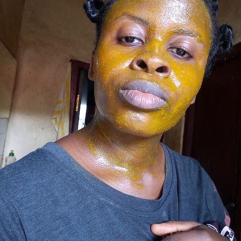 I Tried the Turmeric & Honey Face Mask for Almost Two Weeks! - My Local Adventures Blog Diy Tumeric Face Mask, Tumeric And Honey, Cinnamon Face Mask, Tumeric Masks, Tumeric Face, Turmeric Facial, Lemon Mask, Lemon Face Mask, Honey Facial