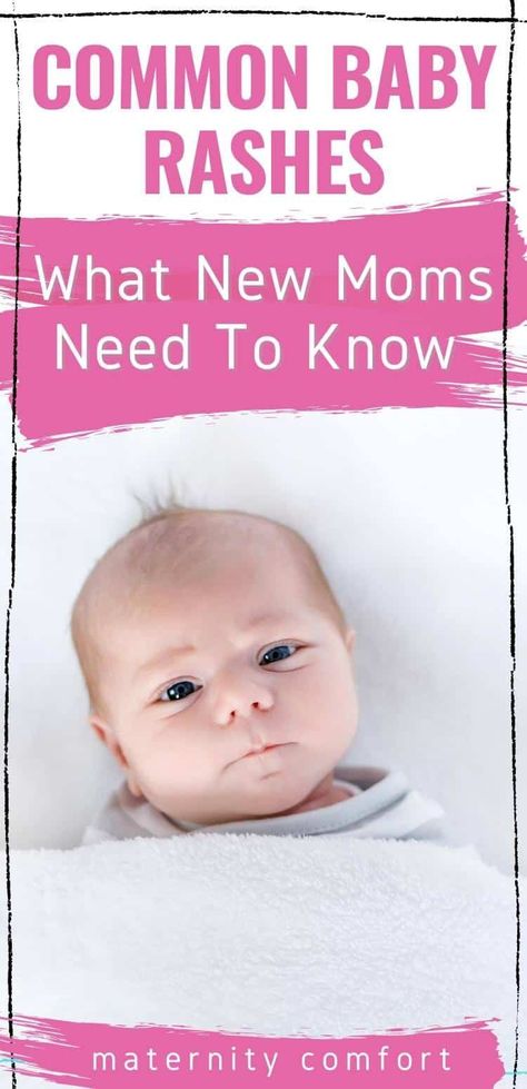 Newborn Rash On Face, Heat Rash Remedy For Babies, Heat Rash On Face, Rash On Stomach, Newborn Rash, Baby Rash On Face, Baby Heat Rash, Heat Rash Remedy, Home Remedies For Rashes