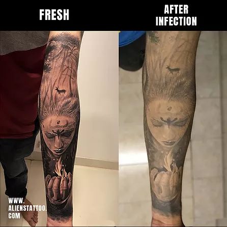 Infected Tattoo Images, mild tattoo infection, Infected tattoo before and after, infected tattoo scab, Tattoo Touch Up Before And After, Tattoo Scabbing, Tattoo Touch Up, Tattoo Aftercare Tips, Aliens Tattoo, Infected Tattoo, Black Color Hairstyles, Becoming A Tattoo Artist, Color Hairstyles