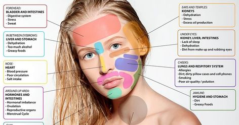 Face Mapping: What Pimples on your Skin tell about your Health Condition? Gesicht Mapping, Doterra Acne, Cheek Acne, Chin Acne, Face Mapping Acne, Face Mapping, Natural Acne Remedies, Acne Causes, Face Acne