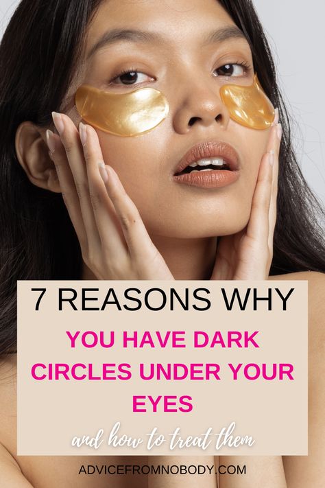 How to Get Rid of Eye Bags. If you want to know how to get rid of puffiness and dark circles under your eyes naturally (and instantly!), we're sharing 10 tips and tricks for fast, overnight relief! From skin care tips, to DIY remedies, to 3 makeup tutorials to teach you how to hide under eye bags with makeup, you don't want to miss this! While we can't promise to banish your dark under eye circles permanently, these beauty hacks definitely help! Hide Under Eye Bags, Black Undereye, Undereye Bags Remedy, Get Rid Of Eye Bags, Rid Of Eye Bags, Dark Undereyes, Dark Under Eye Circles, Baggy Eyes, Reduce Eye Bags