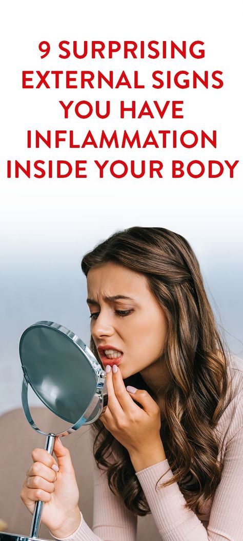 9 Surprising External Signs You Have Inflammation Inside Your Body Skin Inflammation Remedies, Inflammation Remedies, Signs Of Inflammation, Body Inflammation, Nerve Pain Relief, Anti Inflammation, Skin Problems, Facial Skin, Easy Workouts