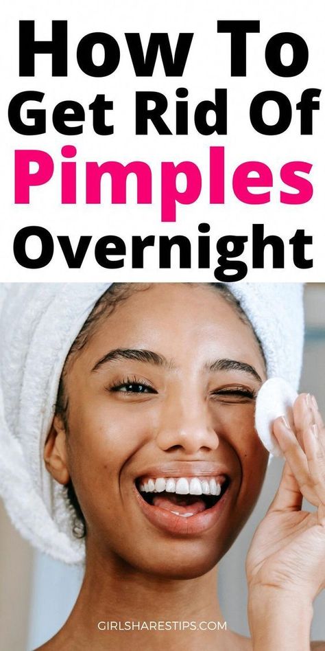 How To Get Rid Of Pimples Overnight - Girl Shares Tips #acne #pimples #pimplesremedies #acneremedies #skincarediy. https://whispers-in-the-wind.com/combatting-pimples-under-the-skin-expert-tips-and-product-recommendations/?32 How To Clear Spots On Face, How To Clear Pimples Overnight, How To Clear Acne Overnight, How To Get Clear Skin Naturally At Home, How To Get Clear Skin In A Week, How To Get Clear Skin Overnight, How To Get Rid Of Pimples Overnight, Clear Up Acne Fast, Clear Acne Overnight