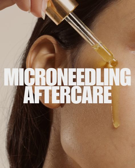 Everything you need to know post-microneedling! Aftercare is so important to achieve great results and are crucial to avoid breakouts and infections. Please follow aftercare instructions carefully always! I’ve also added a short FAQ of questions I get often about microneedling/prp. If you have any more questions or are looking to book a session, DM me or use the link in my bio to book. - #prp #microneedling #microneedlingtreatment #vampirefacialprp #microneedlingaftercare #medspa #holistic ... Prp Microneedling, Dr Pen Microneedling, Microneedling Aftercare, Microneedling Pen, Microneedling With Prp, Rejuvapen Microneedling, Naturopathic Medicine, Iv Therapy, Holistic Medicine