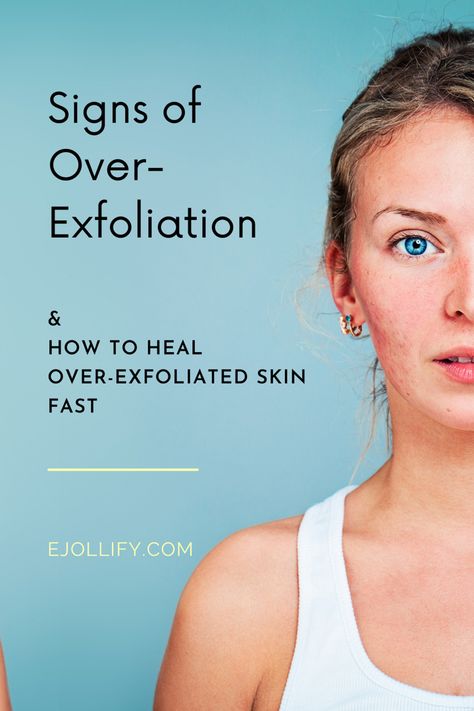 You exfoliate to get rid of rough skin only to get rougher skin. That’s called over-exfoliating your skin. Over-exfoliation occurs when your skin can’t renew fast enough to replace what you’ve been removing from your skin. Keep reading to understand what is over exfoliation, what happens to over-exfoliated skin, the signs of over exfoliation, tips on how to heal over exfoliated skin, and how long does it take to recover. Over exfoliated skin signs | over exfoliating | signs of over exfoliation Rough Face Skin, Over Exfoliated Skin, What To Use To Exfoliate Skin, Rough Skin On Face, How Do You Exfoliate Your Skin, Exfoliation For Sensitive Skin, Dead Skin On Face, What Does Exfoliating Do, How To Exfoliate Face