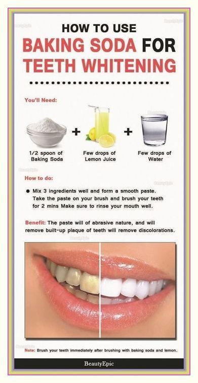 How To Have White Teeth Naturally At Home (Works 100%)! Brushing With Baking Soda, Low Carb Fast Food, Baking Soda Lemon Juice, Lemon Juice Water, Baking Soda And Lemon, Yellow Teeth, Oral Care Routine, Natural Teeth Whitening, Oral Health Care