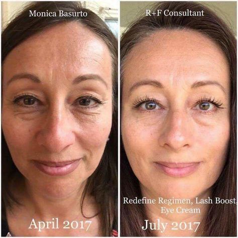 ✨Skin transformation courtesy of Rodan + Fields' Redefine Regimen, beautiful eyes - multifunction eye cream and Lash Boost. What's your holdup? Message me, your results are waiting on you! Click the photo for your FREE skincare recommendation. Anti Wrinkle Skin Care Routine, Multifunction Eye Cream, Redefine Regimen, Skincare Goals, Rodan And Fields Redefine, Aging Backwards, Anti Wrinkle Skin Care, Life Changing Skincare, Skincare Brand