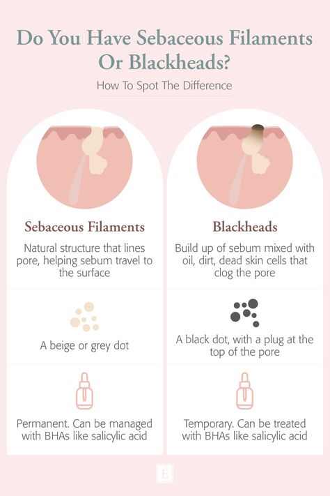 Wondering if you have blackheads? Or are they actually sebaceous filaments? Here's how to spot the difference. #organicskincare #skincaretips #blackheads Sebaceous Filaments, Eminence Organic Skin Care, Prevent Pimples, Cold Sores Remedies, Spot The Difference, Natural Sleep Remedies, Natural Cold Remedies, Get Rid Of Blackheads, Cold Home Remedies