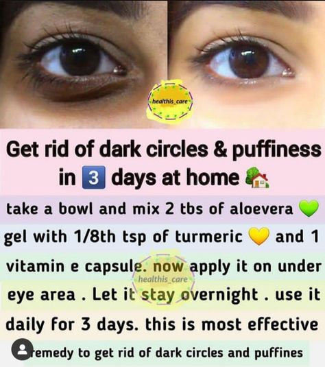 At Home Skincare, Skin Home Remedies, Skin Care At Home, Skin Care Home Remedies, Natural Skin Care Ingredients, Clear Healthy Skin, Eye Skin Care, Natural Skin Care Remedies, Natural Face Skin Care