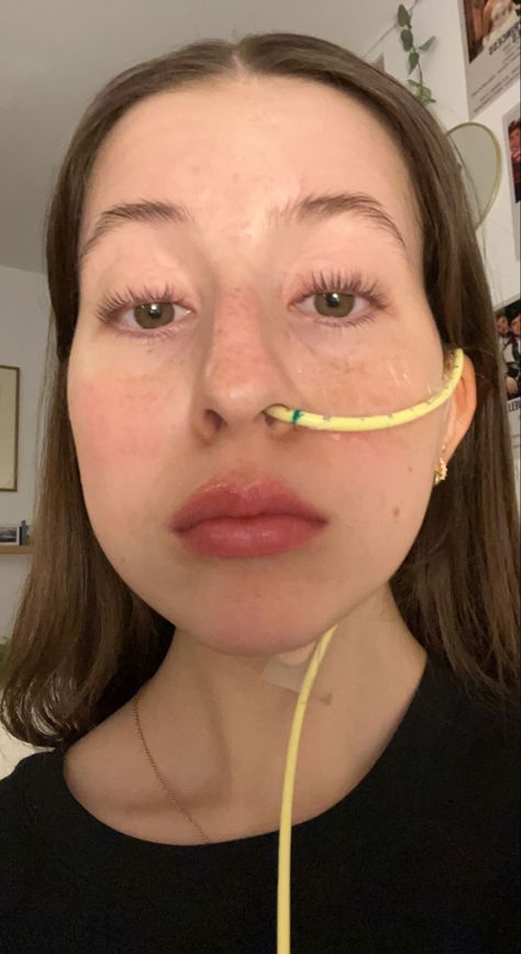 Feeding Tube Aesthetic, Taylor Kelce, Ng Tube, Feeding Tube, Nostril Hoop Ring, Aesthetic Wallpapers, Disease, Nose Ring, Medical