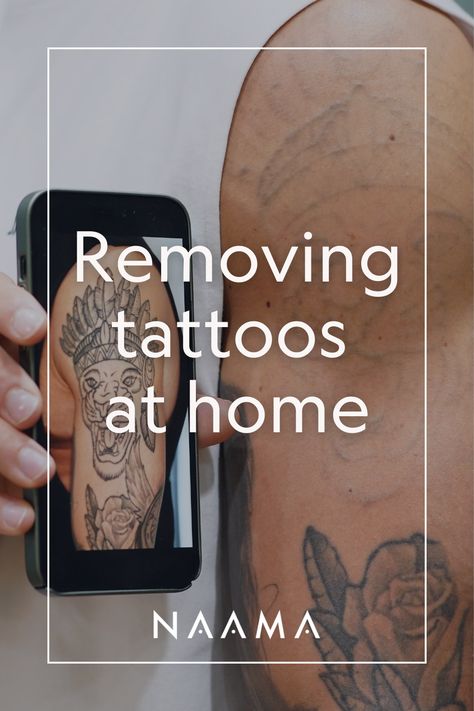 How To Remove A Tattoo At Home, Diy Tattoo Removal, Remove Tattoo At Home, Tattoo Removal Before And After, Tattoos At Home, At Home Tattoo Removal, Tattoo At Home, Inner Lip Tattoo, Tattoo Removal Cream