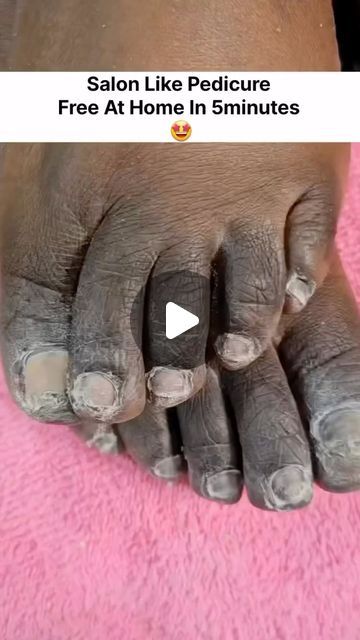 Soft Feet Remedy, Bridal Pedicure, Acrylic Nail Designs Classy, Feet Nail Design, Diy Pedicure, Homemade Facial Mask, Face Skin Care Routine, Foot Pedicure, Diy Skin Care Routine