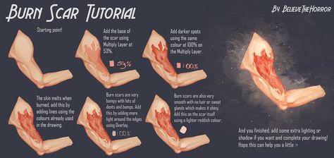 Burn Tutorial Drawing, Burns Reference Drawing, Burn Wounds Reference, Digital Art Burn Scar Tutorial, Fire Scar Reference, Draw Burn Scars Reference, Burn Injury Drawing, Oc With Burn Scar, Burn Scar Tutorial Drawing