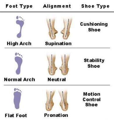 Does foot type, like high or flat arches, and over pronation impact injury rates? What about shoe type - traditional shoes versus minimalist shoes? This site examines the research on the impact of footwear and foot type on injury Shoes For High Arches, Best Nursing Shoes, Minimalist Shoes, Nursing Shoes, Poor Posture, Foot Health, Foot Pain, Injury Prevention, Back Pain