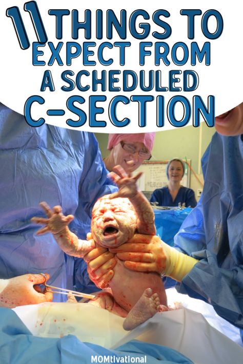 Do you have a scheduled cesarian? If you're feeling nervous, don't be! There are a couple of things you should know before your c-section so you're prepared! Scheduled c section what to expect before you go to the hospital. Learn also what to do before a scheduled c-section and does a c section hurt more than natural birth? #csection #scheduledcsection #cesarian C-section, C Section Photography, C Section Tips, Cesarian Section, Healing From C Section, Scheduled C Section, C Section Workout, Feeling Nervous, Birth Videos