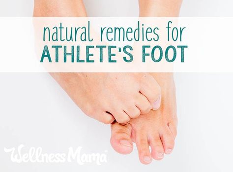 No one likes athlete's foot. Learn 5 effective natural remedies that are easy to make with ingredients you probably already have at home. Wellness Mama, Athletes Foot, Natural Therapy, Natural Health Remedies, Natural Home Remedies, Natural Home, Health Matters, Diy Natural Products, Natural Wellness