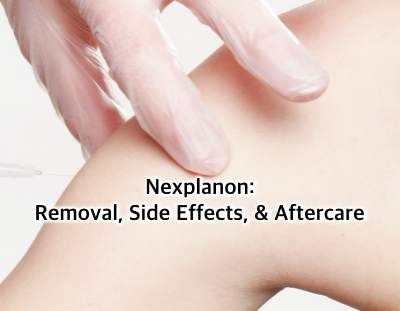 Discover the facts and FAQs surrounding Nexplanon removal for a smooth and informed experience. Get the lowdown on nexplanon removal now - #CanIgetpregnantafterNexplanonremoval.Implantremovalprocedure #Contraceptiveimplantextraction #HowtoprepareforNexplanonremoval #IsNexplanonremovalpainful #Nexplanonimplantremoval.WhathappensduringNexplanonremoval #Nexplanonremovalprocess... Nexplanon Implant, Birth Control Implant, Abdominal Pain Relief, Birth Control Options, Contraception Methods, Forms Of Birth Control, Birth Control Methods, Proper Hygiene, Birth Control