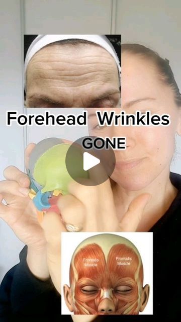 Taping Forehead Wrinkles, Face Yoga For Forehead Wrinkles, Forehead Wrinkles Exercises, Face Yoga Forehead Wrinkles, Massage For Forehead Wrinkles, Deep Wrinkles Forehead, How To Get Rid Of Forehead Wrinkles, Gua Sha Forehead Wrinkles, Face Taping For Wrinkles