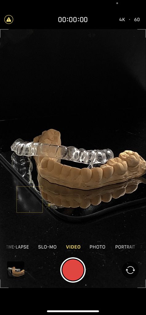 Dental student dentistry dentist teeth photography phone retainer invisalign Dental Wallpaper, Dental Assistant Study, Teeth Doctor, Dental Photos, Dental World, Dental Posts, Dental Aesthetics, Kedokteran Gigi, Dental Photography