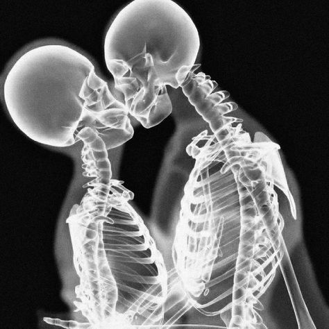 ORIVGINAL on Instagram: “skeleton love ☠️” Skeleton, Black And White, On Instagram, White, Black, Instagram