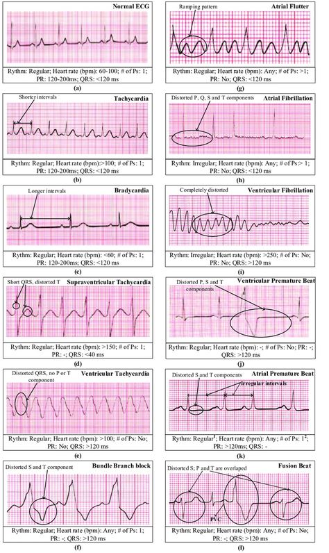 Nursing School Essential, Nursing School Motivation, Medical School Life, Basic Anatomy And Physiology, Nurse Study Notes, Nursing Mnemonics, Nursing Student Tips, Medical Student Study, Cardiac Nursing