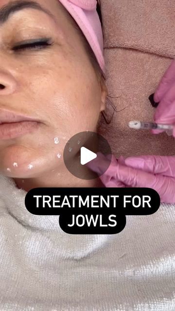 Aesthetic Practitioner, Lower Face Lift, Face Injections, Botox Before And After, Botox Face, Thread Lift, Anti Wrinkle Treatments, Cosmetic Injectables, Cosmetic Procedures