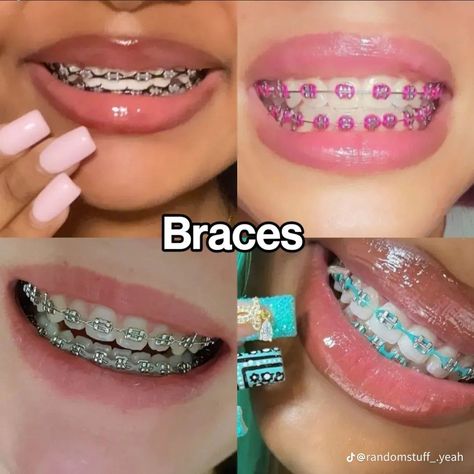 Aesthetic Braces Color, Hot Pink Braces, Perfect Teeth Braces, Purple Braces, Power Chain Braces, Dental Braces Colors, Braces Colors Combinations, Pink Braces, Red Braces