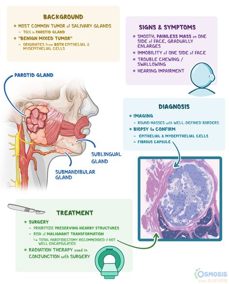 Pleomorphic adenomas are the most common tumors of the salivary glands Med Notes, Salivary Glands, Medical Study, Nursing 101, Salivary Gland, Family Nurse Practitioner, Study Essentials, Medical Student Study, Medical School Essentials