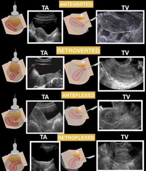 Obgyn Sonographer, Ultrasound Technician School, Gyn Ultrasound, Fetal Ultrasound, Diagnostic Medical Sonography Student, Ultrasound School, Ultrasound Physics, Obstetric Ultrasound, Medical Radiography